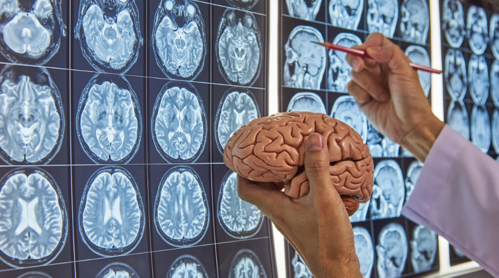 BrainPathJunction: The Crucial Intersection of Neural Pathways BrainPathJunction: The Crucial Intersection of Neural Pathways